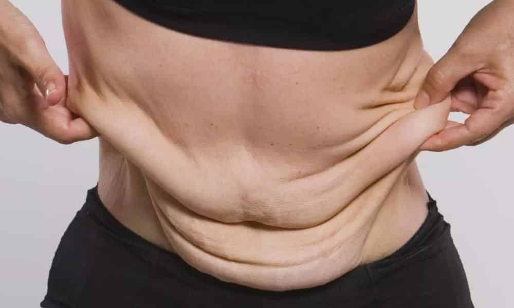 7 dicas valiosas para acabar com a flacidez do seu corpo