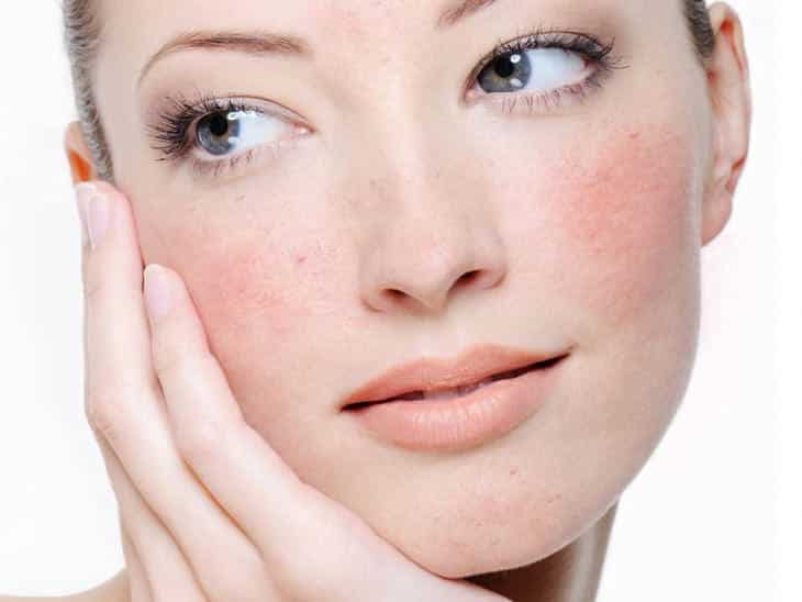 Sensitive skin, what it is, what are the symptoms and treatments