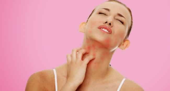 Sensitive skin, what it is, what are the symptoms and treatments