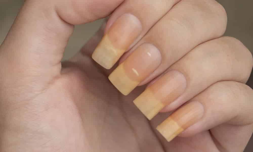 Yellow nails can indicate health problems