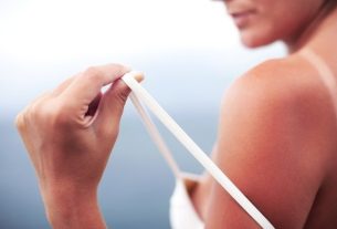 5 tips to treat sunburn faster