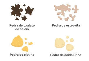 4 tipos de cálculos renales (alimentos y cómo eliminarlos)