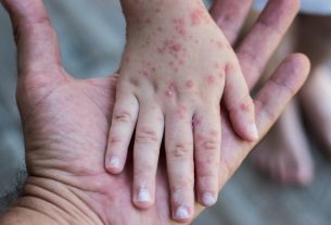 8 main symptoms of rubella