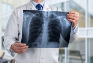 8 main symptoms of tuberculosis (with online test)