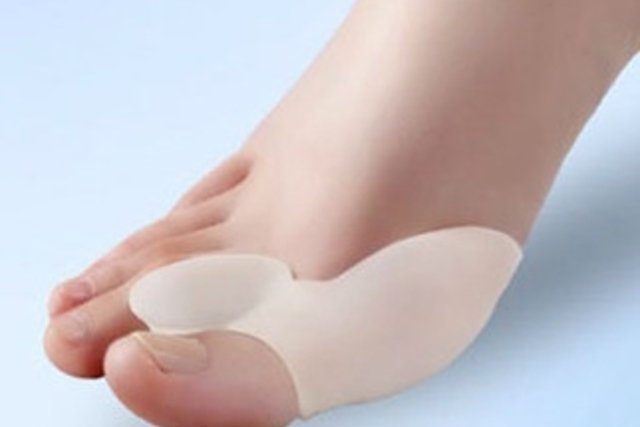 Bunion exercises and how to care for your feet