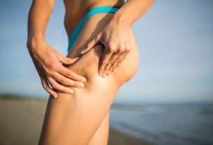 Cellulite: what it is, how to identify, degrees, causes and treatment