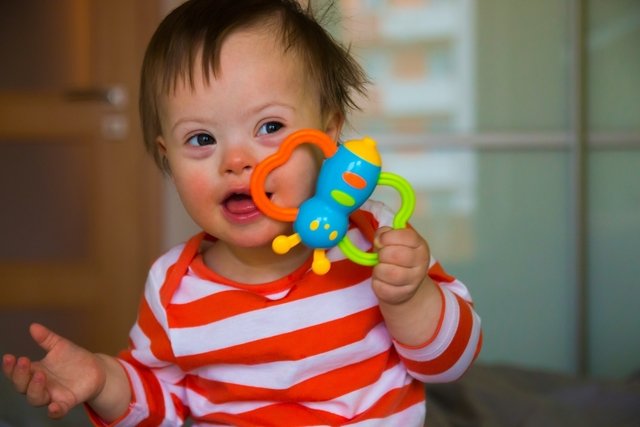 Characteristics of down syndrome: physical, cognitive and behavioral