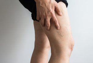 Foam sclerotherapy: what it is and how it is done and possible risks