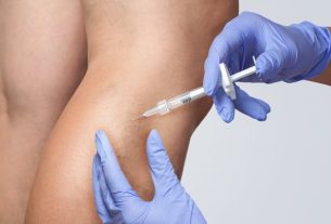 Glucose sclerotherapy: what it is, how it is done and side effects