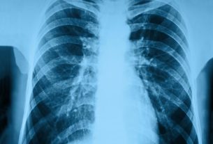 Hospital pneumonia: what it is, symptoms, causes and treatment