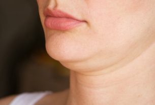 How to get rid of a double chin (double chin)