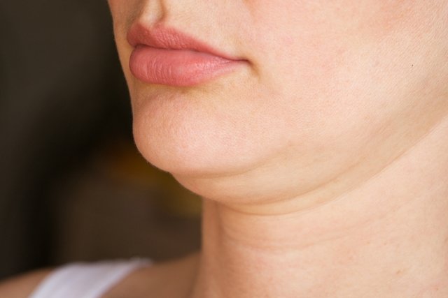 How to get rid of a double chin (double chin)