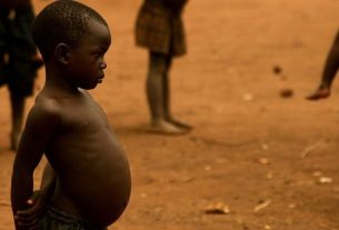 Kwashiorkor: what it is, symptoms, causes and treatment