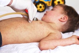 Measles: what it is, symptoms, transmission and treatment