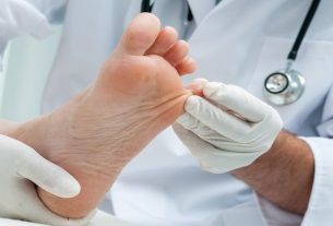 Mycosis on the foot (ringworm): what it is, symptoms and treatment