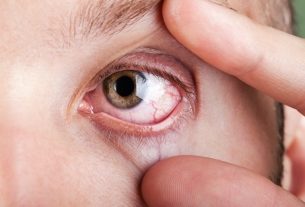 Ocular toxoplasmosis: what it is, symptoms and treatment