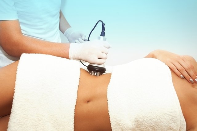 Radiofrequency on the belly: benefits and how it is done