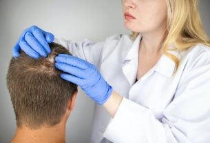 Ringworm on the scalp: symptoms, causes and treatment