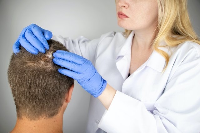 Ringworm on the scalp: symptoms, causes and treatment