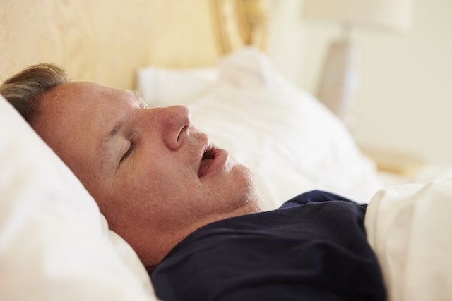 Sleep apnea: what it is, symptoms, causes and treatment