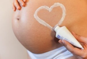 Stretch marks during pregnancy: how to remove or prevent them from appearing