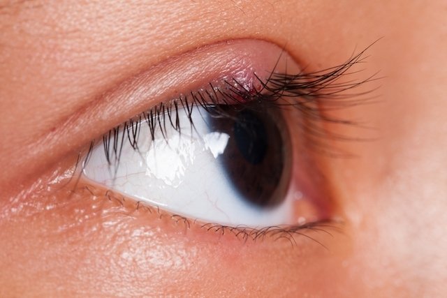 Stye treatment: ointments, homemade options and care