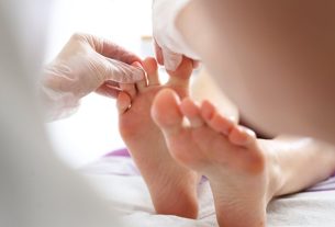 Tinea pedis: what it is, symptoms, causes and treatment