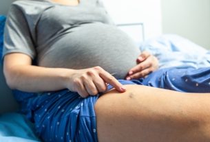 Varicose veins during pregnancy: symptoms, causes, treatment and how to avoid