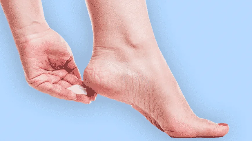 Foot cream - what it is and how to choose the best one