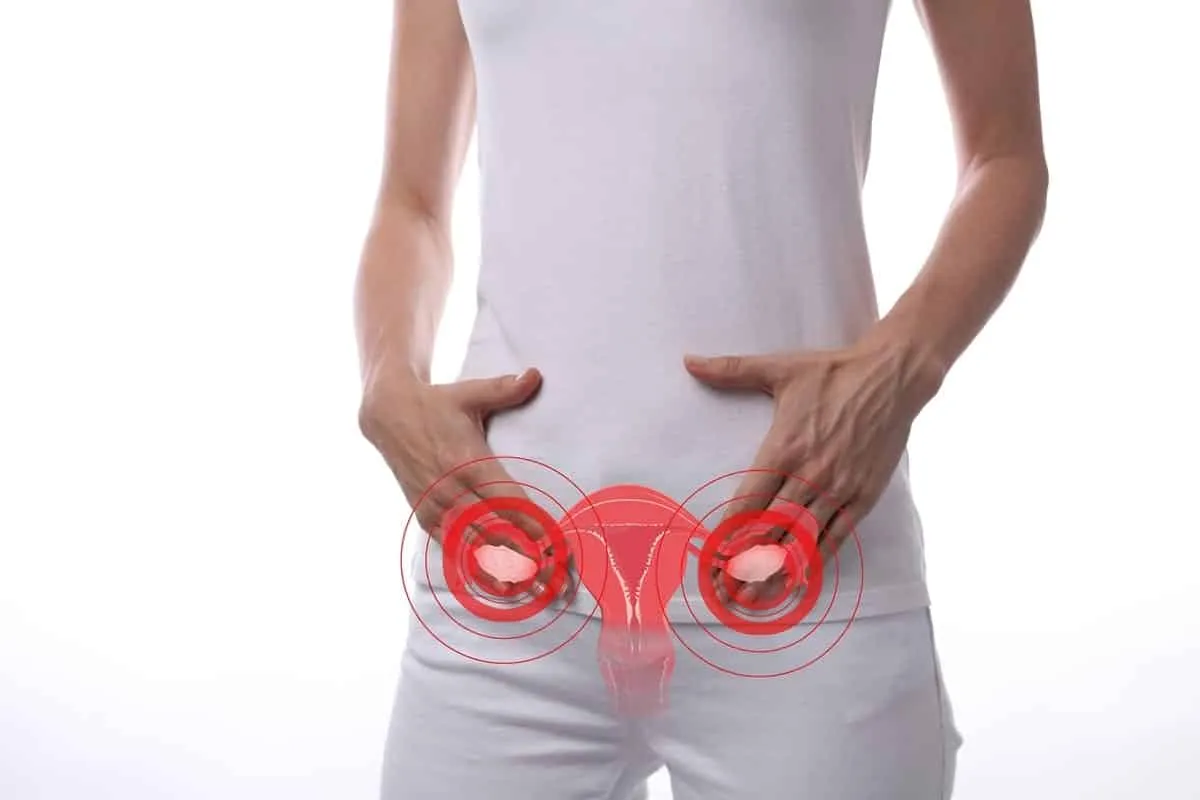 Polycystic ovary – What it is, causes, symptoms, treatments and curiosities