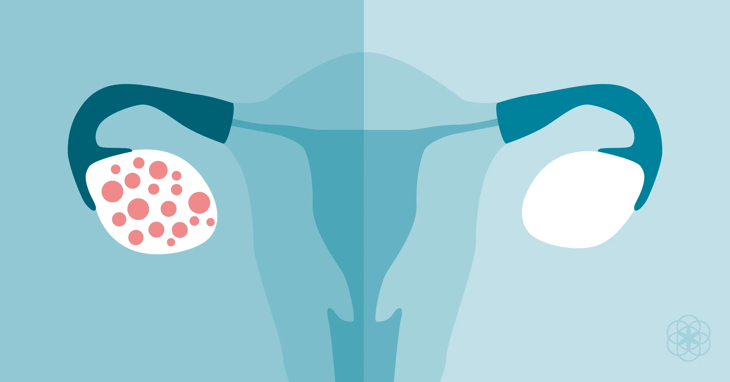 Polycystic ovary – What it is, causes, symptoms, treatments and curiosities