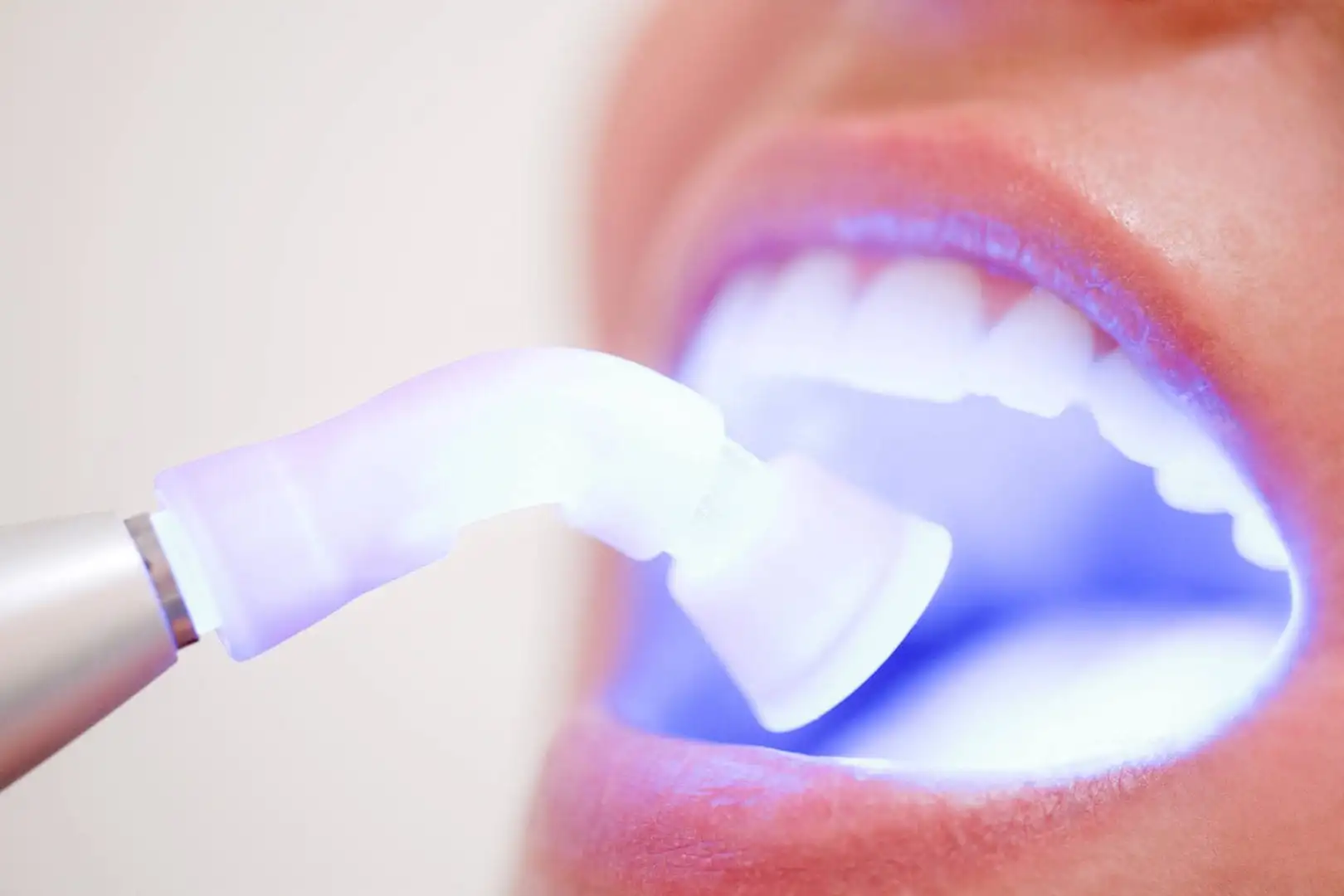 White teeth - main office and home treatments