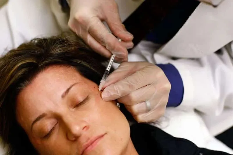 Botulinum toxin: what it is and what the famous botox is for