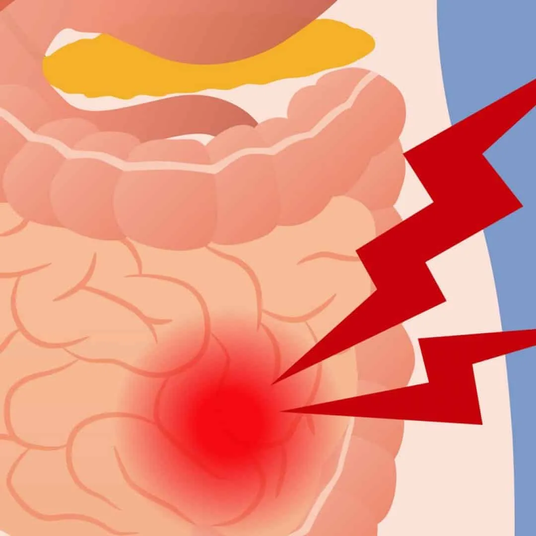 Vorteile von Schokolade – sie ist nicht nur köstlich, sondern auch gut für Ihre Gesundheit