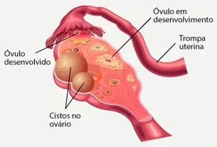 remèdes, chirurgie et options naturelles