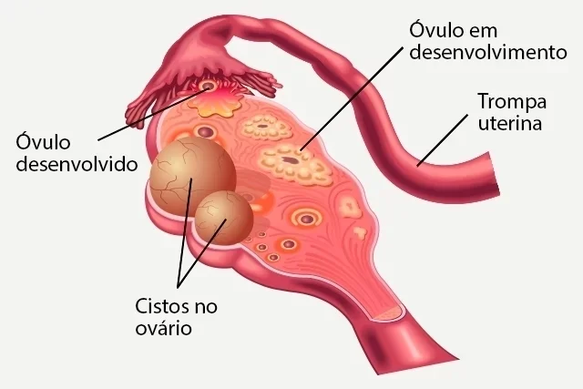 remèdes, chirurgie et options naturelles