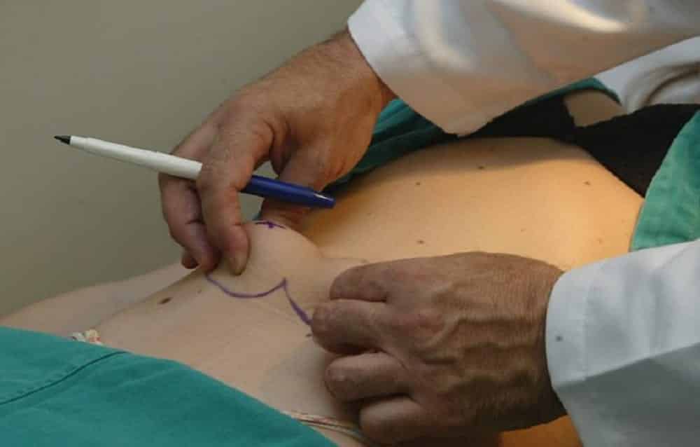 Cirurgia plástica pelo SUS: saiba quando é possível e como conseguir