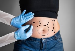 Main risks of abdominoplasty and how to avoid them