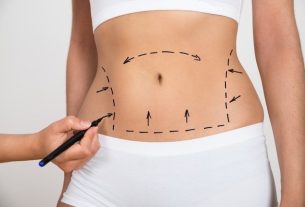 Abdominoplastia com lipo: como é feita, resultados e pós-operatório