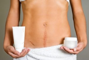 5 Treatments to remove old scars