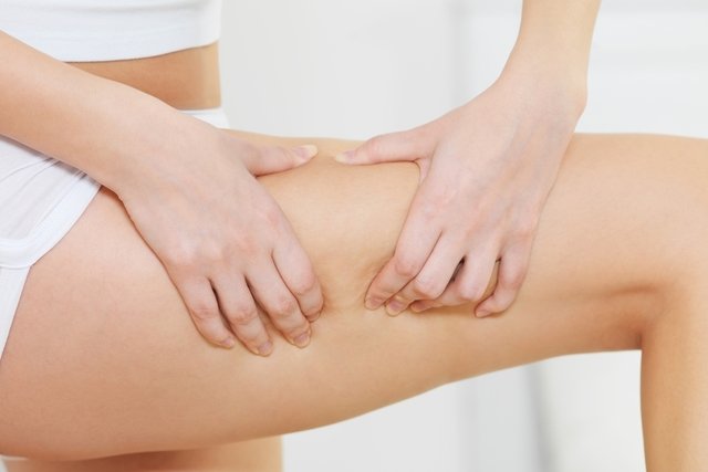 Thigh Lift: what it is, how it is done, and recovery