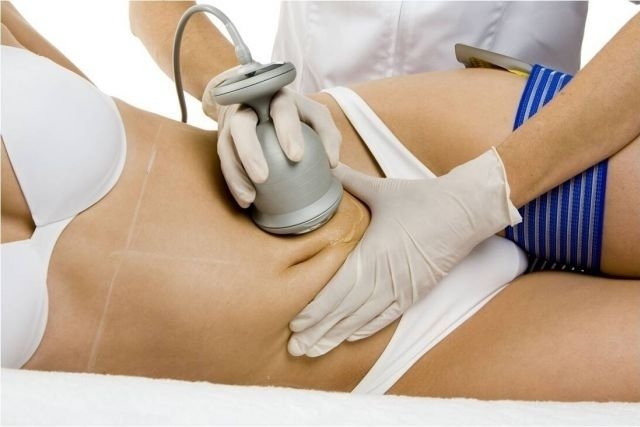 All about non-invasive liposuction