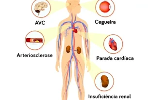 El exceso de sal es perjudicial para tu salud