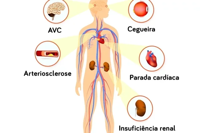 El exceso de sal es perjudicial para tu salud