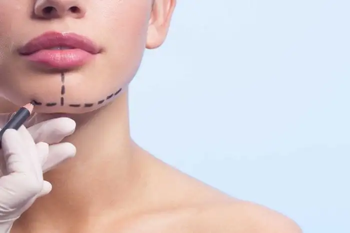 Plastic surgery through the SUS: find out when it is possible and how to get it