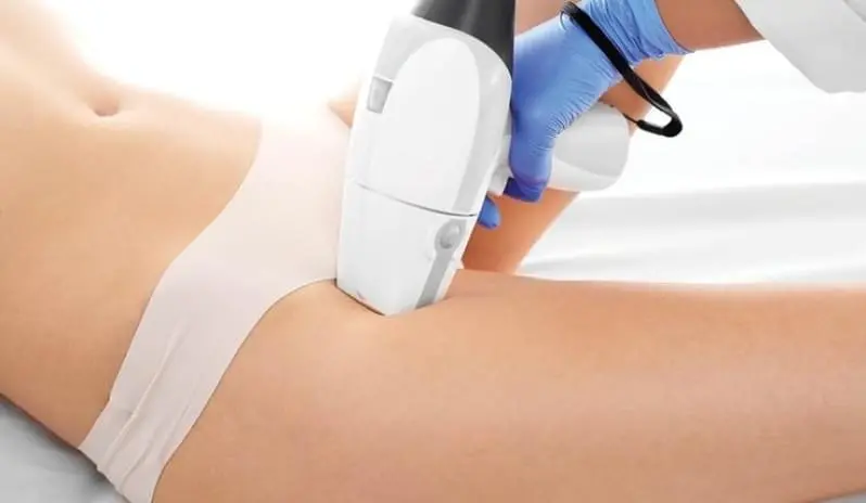 Laser hair removal, how it is done and the most common questions