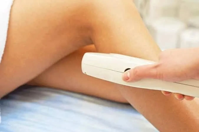 Laser hair removal, how it is done and the most common questions