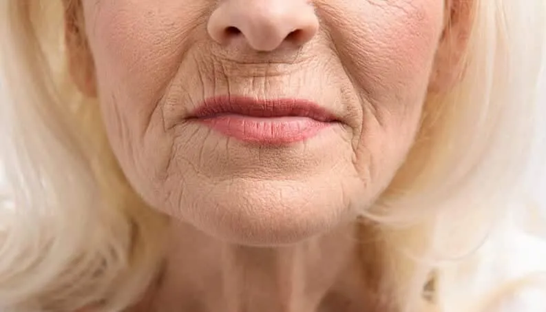 Wrinkles - how to prevent them and what are the best treatments