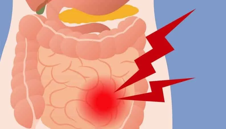 10 little-known causes of constipation