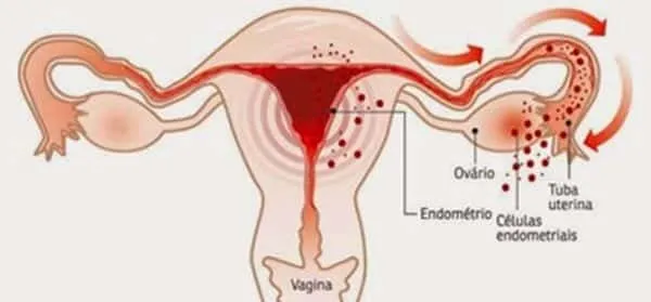 Brown period?  See why this happens.